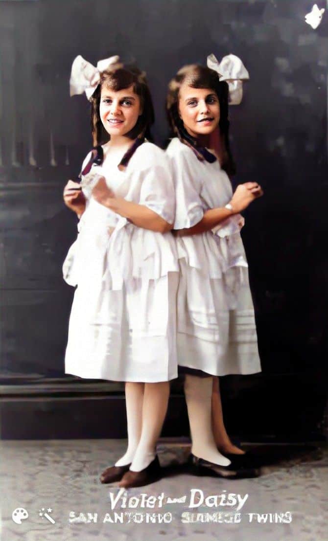 siiamilaiset kaksoset Daisy ja Violet 1900-luvun alkupuolelta Englanniss
