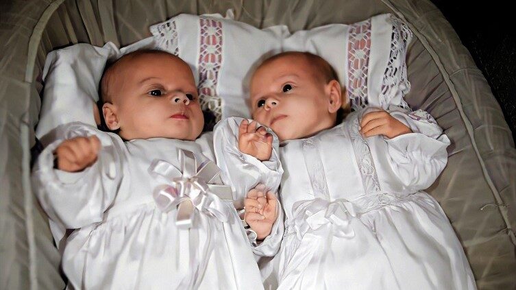 Kaksoset – Voiko kaksosilla olla eri isä ja muuta mielenkiintoista